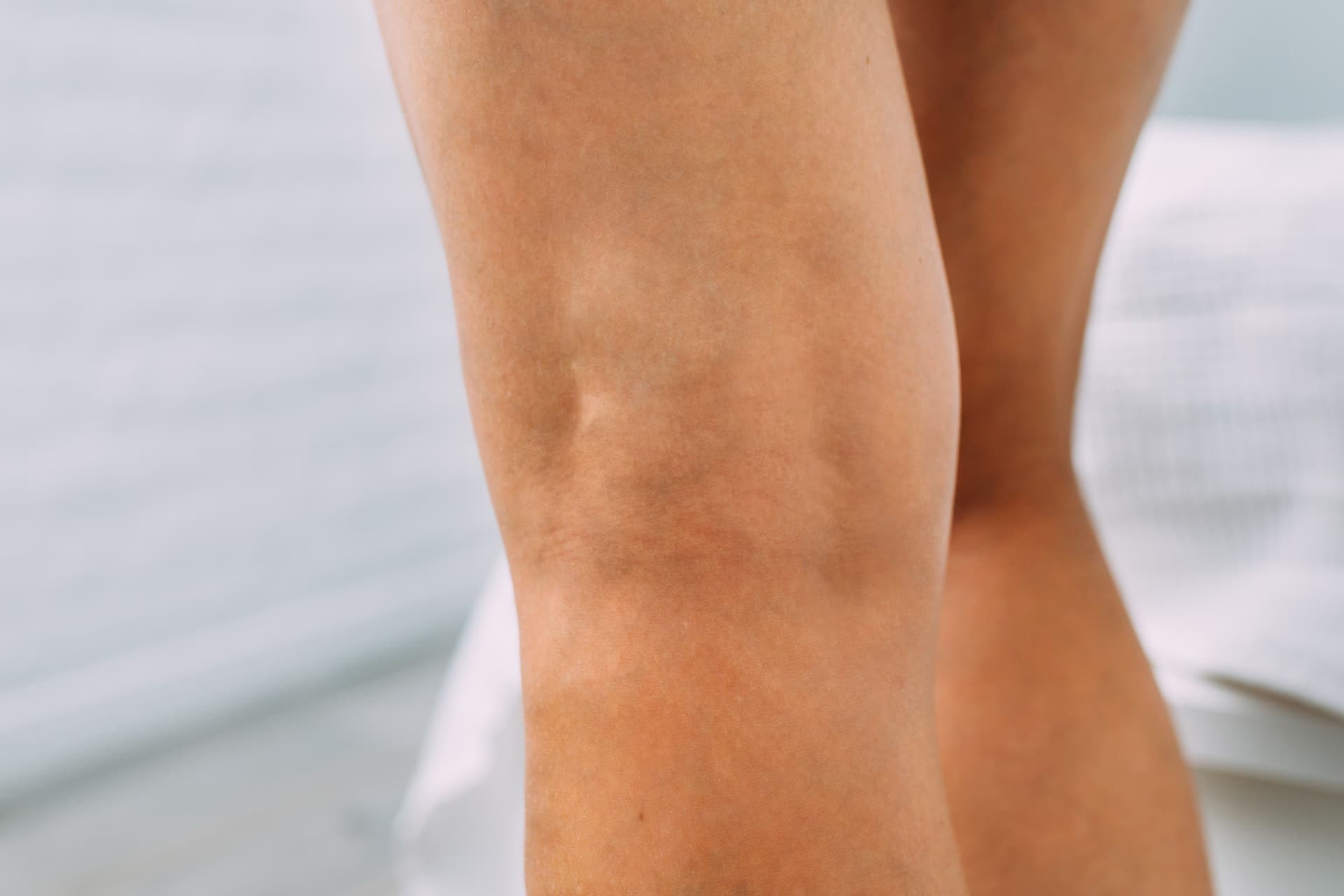 Depois do tratamento