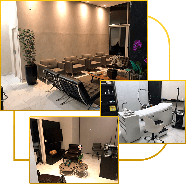 Tratamento de varizes com laser sem cirurgia na Clinica AngioGold Belo Horizonte