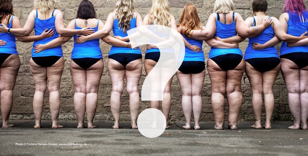 Lipedema — informacoes e tratamento na Clinica AngioGold Belo Horizonte