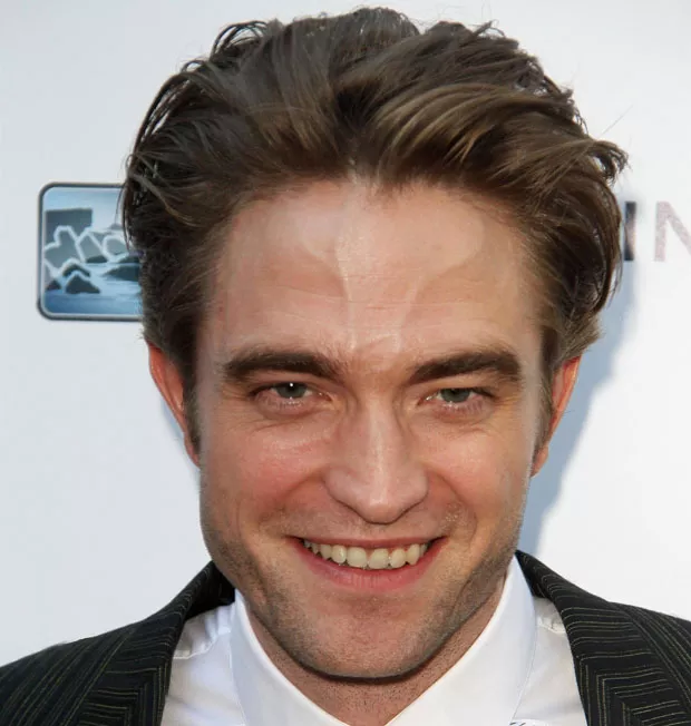 Tratamento de veia da testa na Clinica AngioGold Belo Horizonte