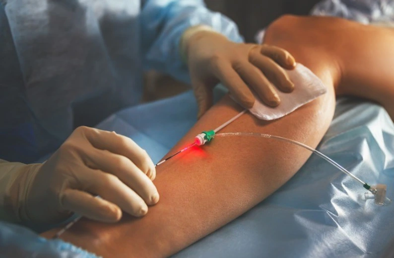 Dr. Carlos Eduardo Jorge, angiologista da AngioGold — tratamento da safena com endolaser sem cirurgia em Belo Horizonte