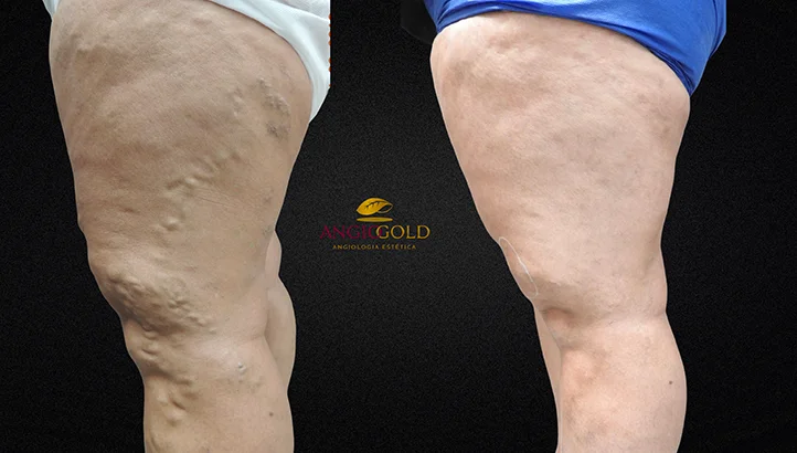 Dr. Carlos Eduardo Jorge, angiologista responsavel pela Clinica AngioGold Belo Horizonte