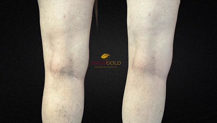 Dr. Carlos Eduardo Jorge, angiologista responsavel pela Clinica AngioGold Belo Horizonte