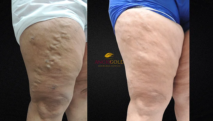 Dr. Carlos Eduardo Jorge, angiologista responsavel pela Clinica AngioGold Belo Horizonte