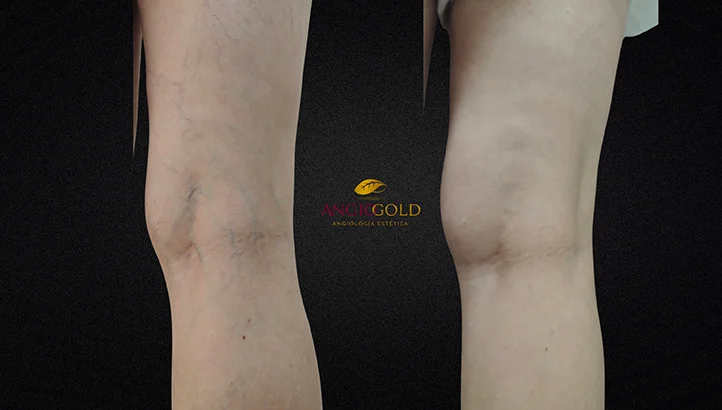 Dr. Carlos Eduardo Jorge, angiologista responsavel pela Clinica AngioGold Belo Horizonte