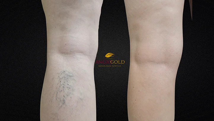 Dr. Carlos Eduardo Jorge, angiologista responsavel pela Clinica AngioGold Belo Horizonte