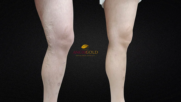 Dr. Carlos Eduardo Jorge, angiologista responsavel pela Clinica AngioGold Belo Horizonte