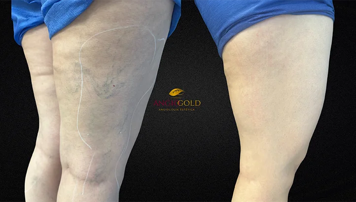 Dr. Carlos Eduardo Jorge, angiologista responsavel pela Clinica AngioGold Belo Horizonte