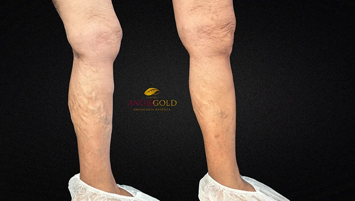 Dr. Carlos Eduardo Jorge, angiologista responsavel pela Clinica AngioGold Belo Horizonte