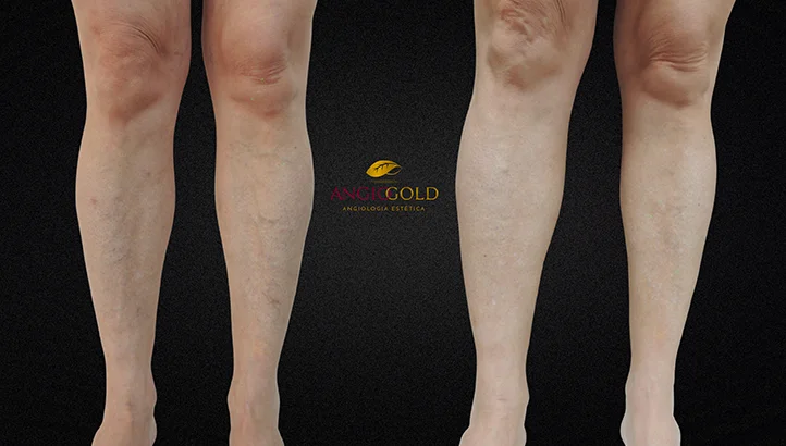 Dr. Carlos Eduardo Jorge, angiologista responsavel pela Clinica AngioGold Belo Horizonte