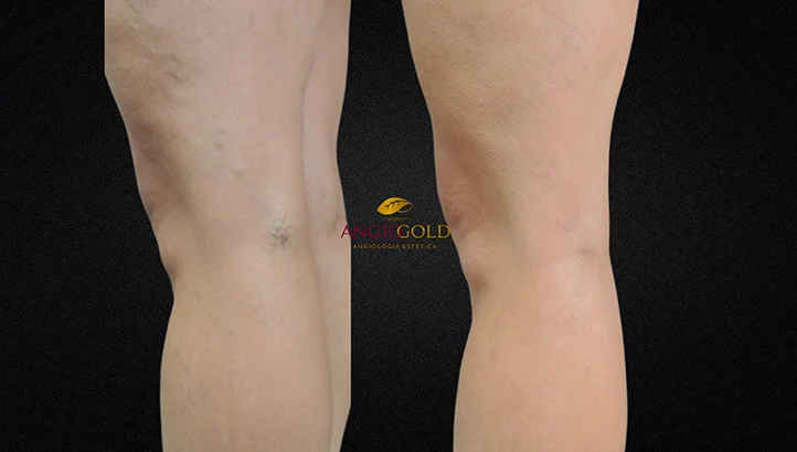 Dr. Carlos Eduardo Jorge, angiologista responsavel pela Clinica AngioGold Belo Horizonte