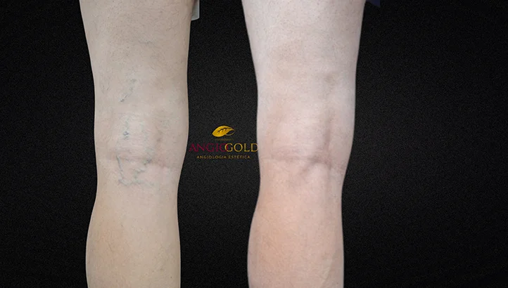 Dr. Carlos Eduardo Jorge, angiologista responsavel pela Clinica AngioGold Belo Horizonte