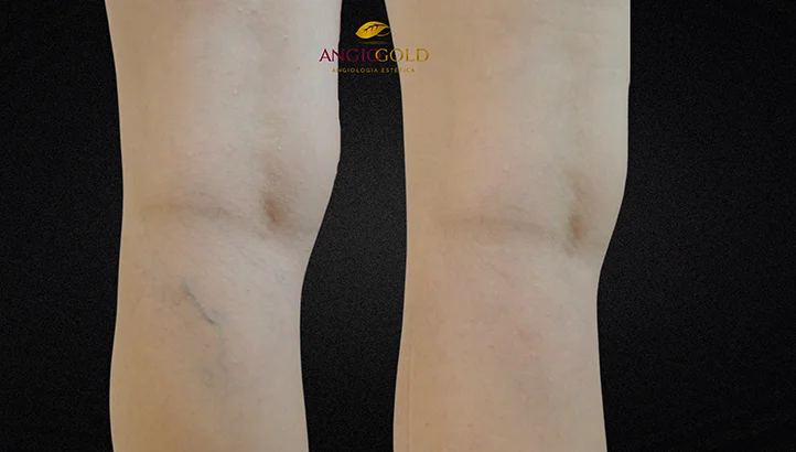 Dr. Carlos Eduardo Jorge, angiologista responsavel pela Clinica AngioGold Belo Horizonte