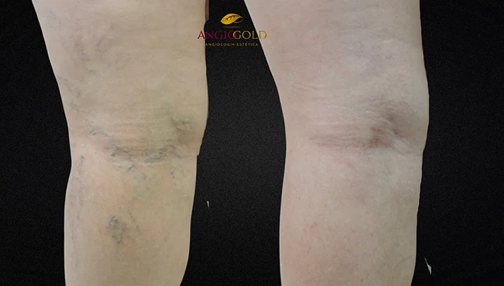 Dr. Carlos Eduardo Jorge, angiologista responsavel pela Clinica AngioGold Belo Horizonte