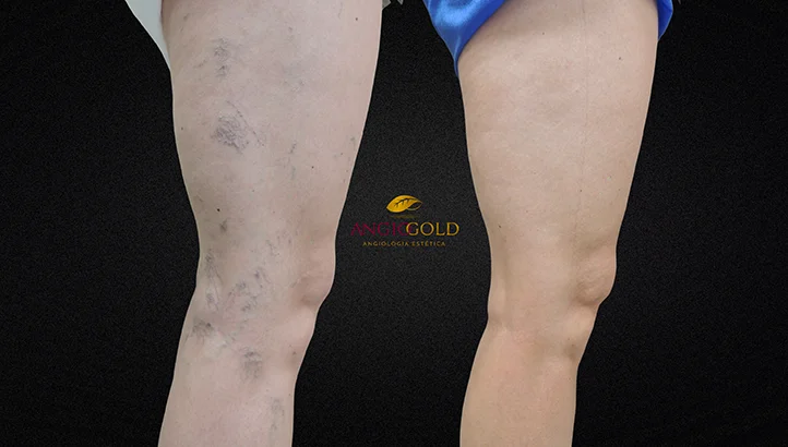 Dr. Carlos Eduardo Jorge, angiologista responsavel pela Clinica AngioGold Belo Horizonte