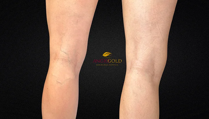 Dr. Carlos Eduardo Jorge, angiologista responsavel pela Clinica AngioGold Belo Horizonte