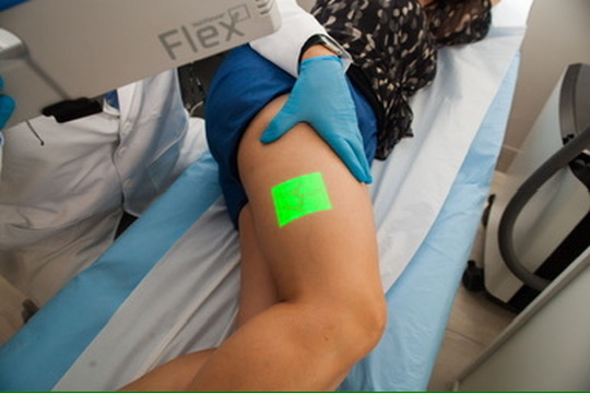 Mapeamento Vein Viewer