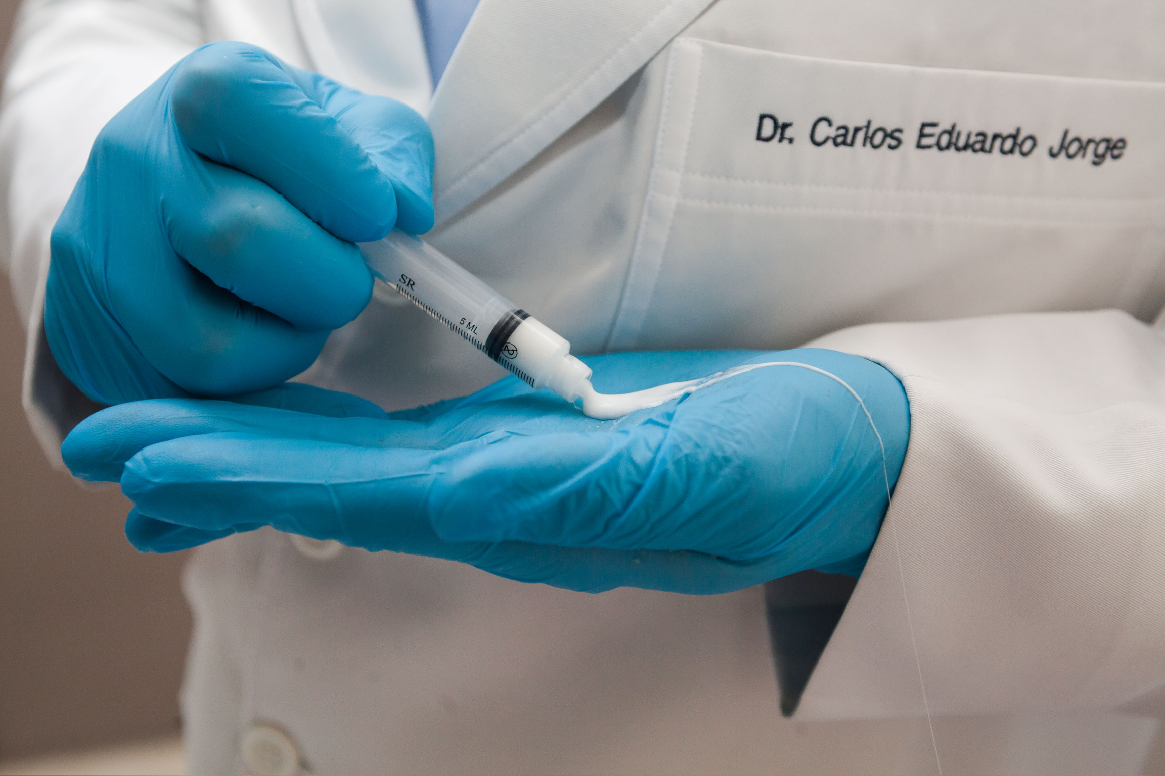 Escleroterapia com espuma — Dr. Carlos Eduardo Jorge aplicando tratamento de varizes