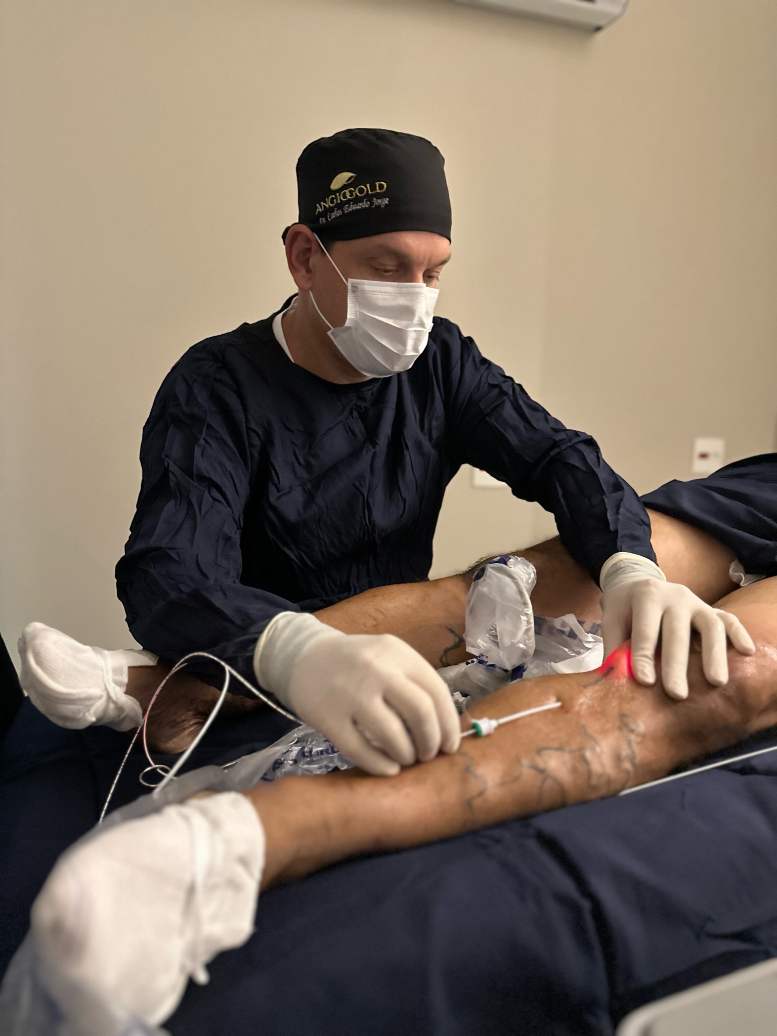 Tratamento de safena sem anestesia geral sendo realizado pelo Dr. Carlos Eduardo Jorge na Clínica AngioGold com endolaser e técnica tumescente