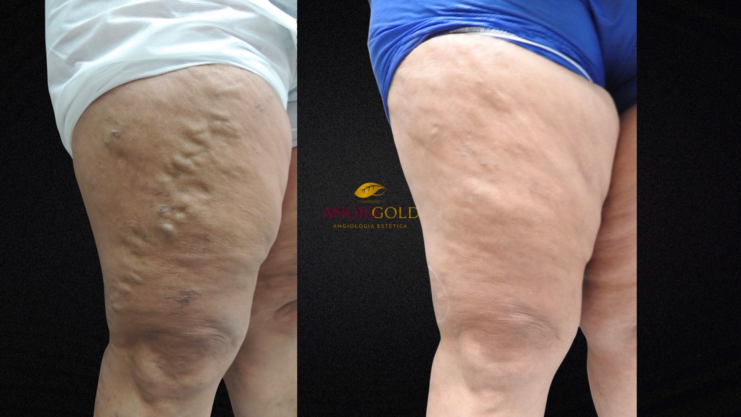 Antes y después · caso 09