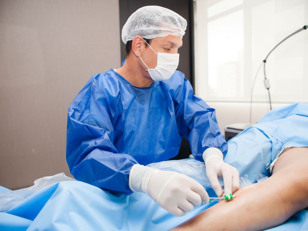 Dr. Cadu paramentado realizando endolaser de safena em campo estéril