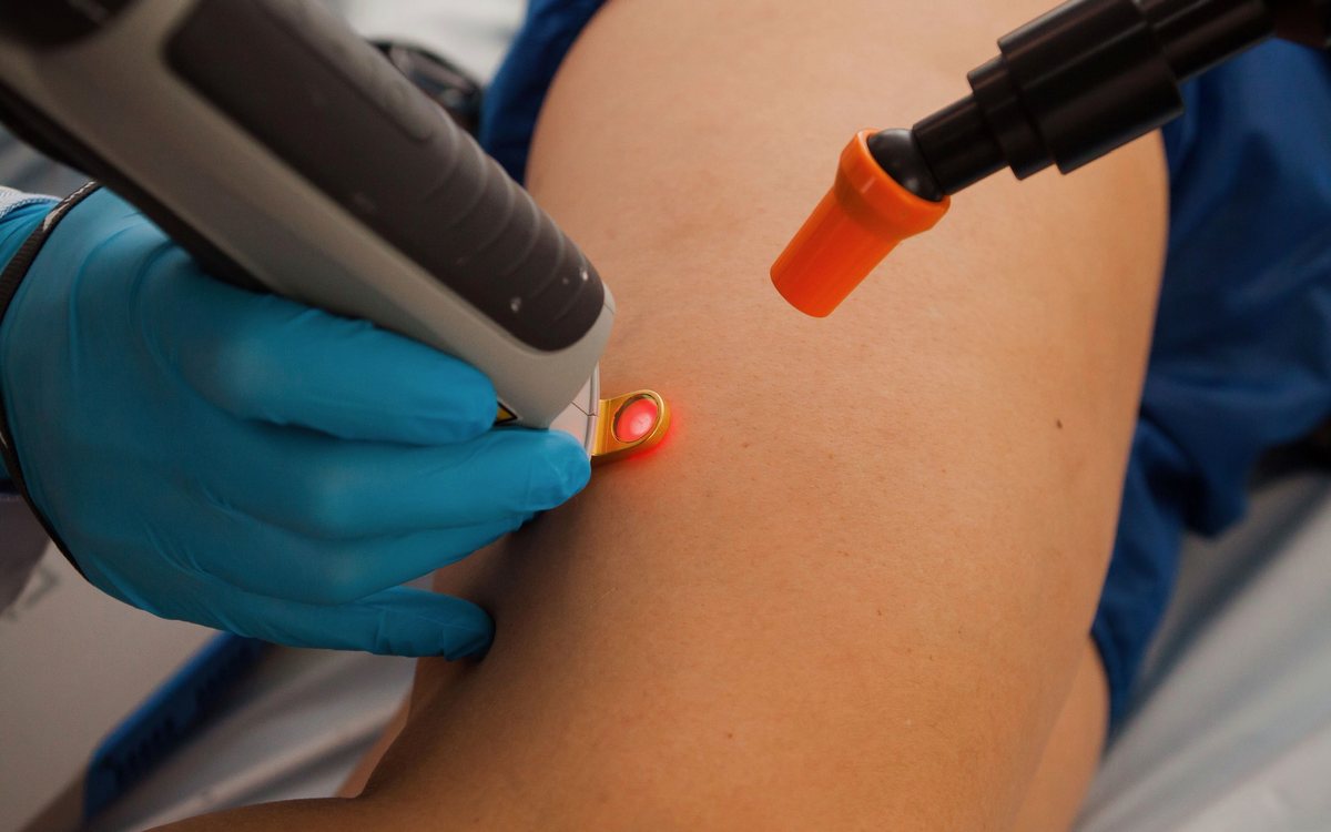 Aplicação do laser transdérmico por fora da pele, sem cortes