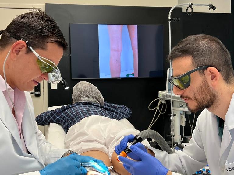 Perna da paciente ampliada no monitor durante a sessão de laser